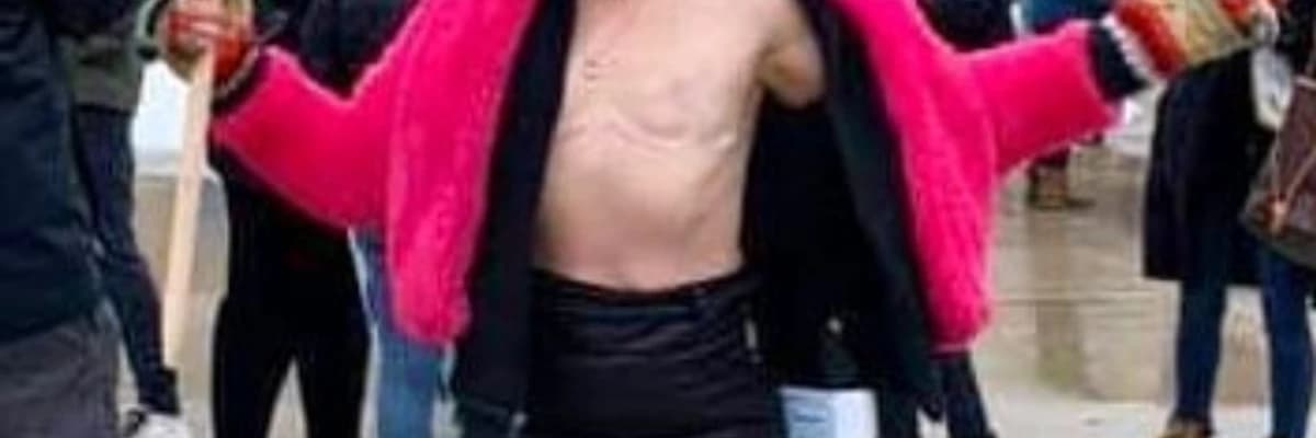 Breast Reconstruction After Mastectomy