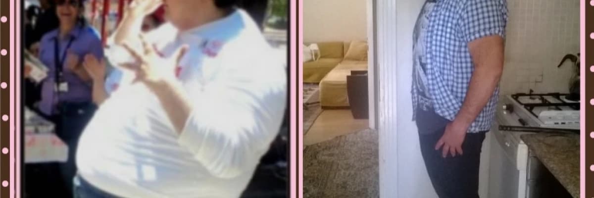 OBEZİTE ve TEDAVİSİ