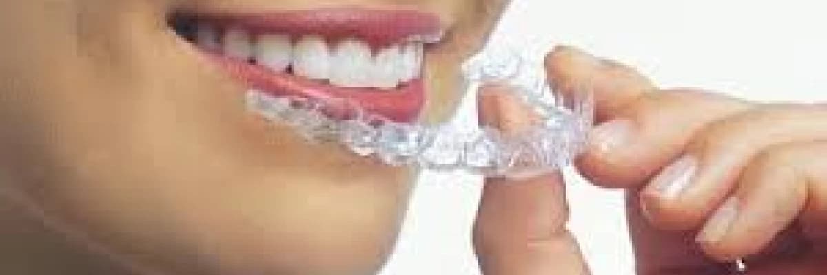 Invisalign İle Tedavi