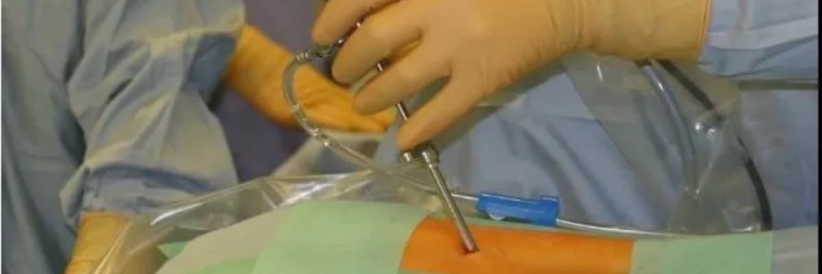 Bel Fıtığında Yeni Dönem: Endoskopik bel fıtığı ameliyatı