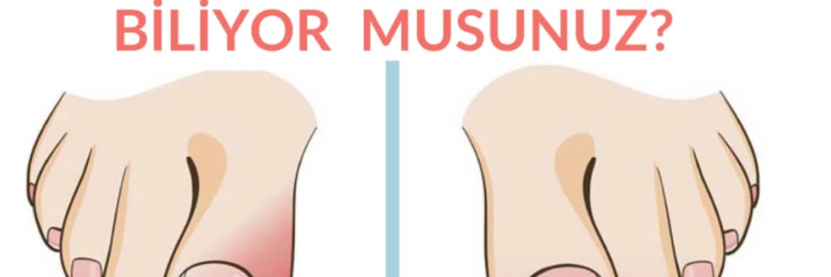 Batık Tırnak Probleminize Uygun Bir Çözüm