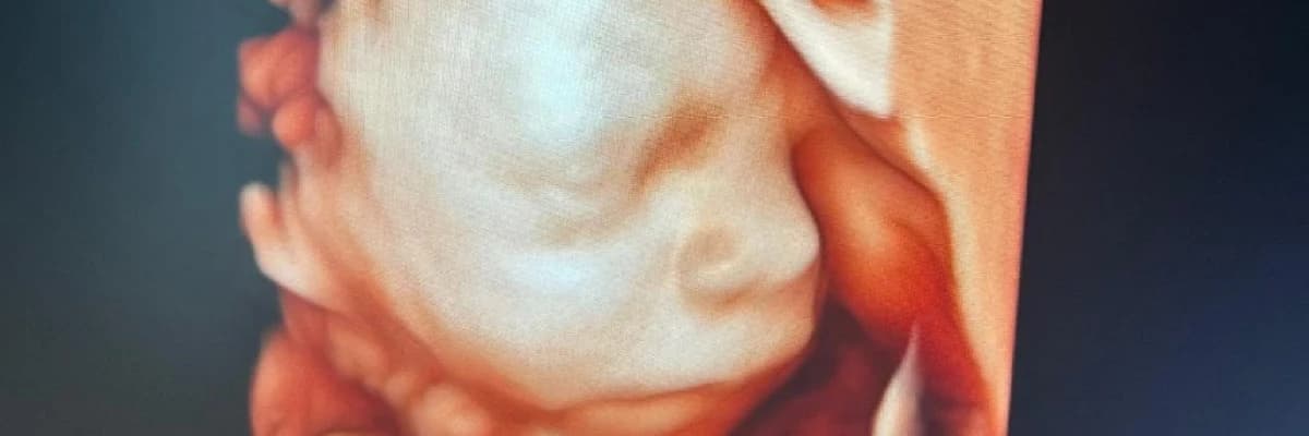 Detaylı Ultrason: Tanımı, Uygulama Yöntemleri ve Zamanlaması