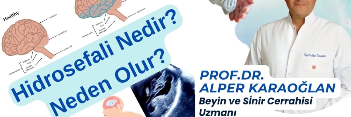 HİDROSEFALİ’nın Başlıca İki Türü ve Nedeni / Kommunike (İletişimli) ve Non-Kommunike Hidrosefali