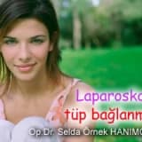 Laparoskopik tüp bağlanması