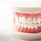 Diş Protezi Nedir, Protez Çeşitleri Nelerdir?