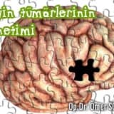 Beyin tümörlerinin yönetimi