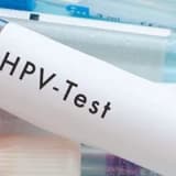 HPV testi nedir?