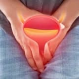 VARİKOSEL NEDİR? | Erkek Kısırlığında Sessiz Tehlike ve Mikrocerrahi Çözümü