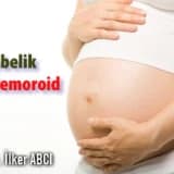 Gebelik ve hemoroid