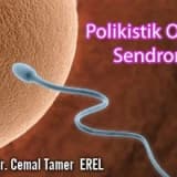 Polikistik over sendromu,