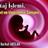 Kürtaj işlemi, riskleri ve uygulama zamanı