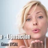 Vibro - liposuction