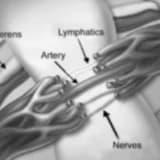 MİKROCERRAHİ VARİKOSEL AMELİYATI