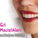 Diş Eti Hastalıkları