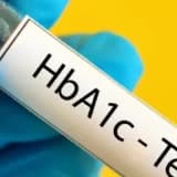Hba1c nedir diyabet açısından önemi?