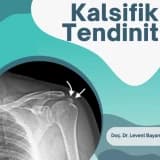 Kalsifik Tendinit