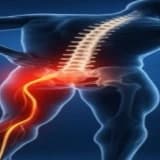 Siyatik Ağrı Nedir? Bel Fıtığı ile Neden Karıştırılır? Ne Zaman Fizyoterapiste Gitmelisiniz?