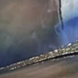 Ultrasound-guided intralesional methylene blue injection for the arthroscopic decompression of spinoglenoid notch cyst causing suprascapular neuropathy